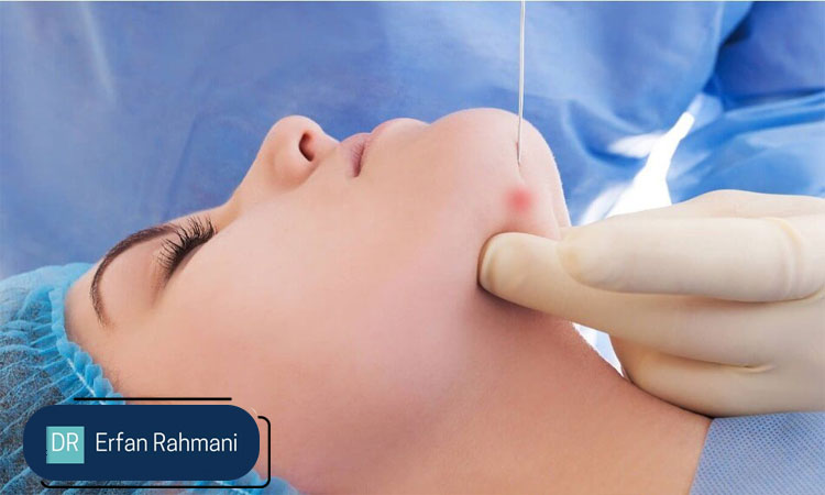 Endolift-Treatment-in-Bin-Zayed-City