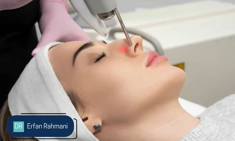 Fotona-Laser-Treatment-JBR-Dubai