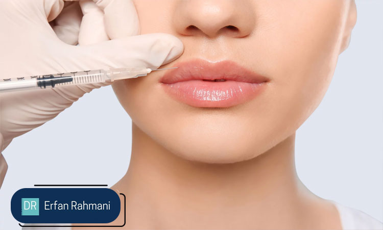 Lip-Filler-Near-JBR-Dubai