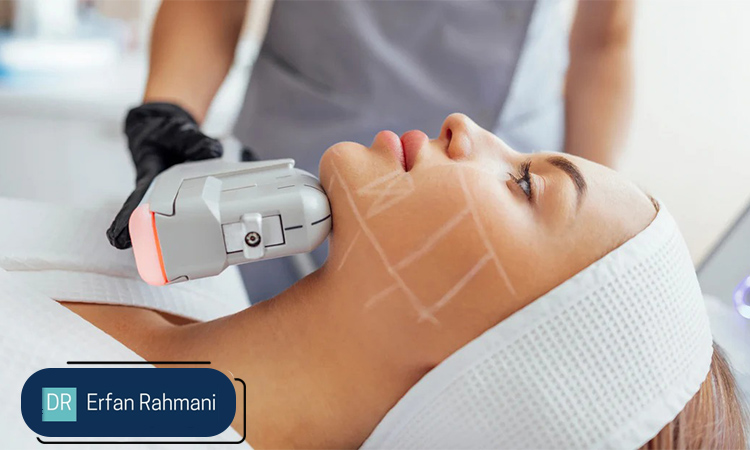 Long-Term Benefits of HIFU for Skin Health