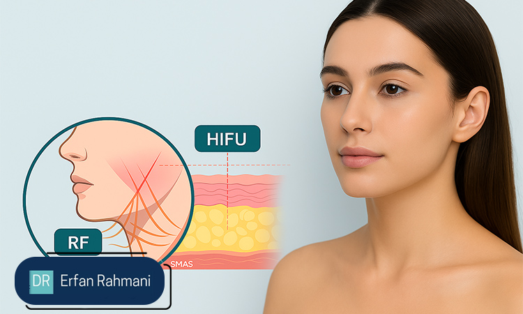 Does HIFU make face thinner