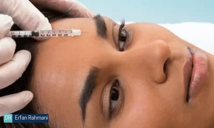 How Long Does Botox Last?