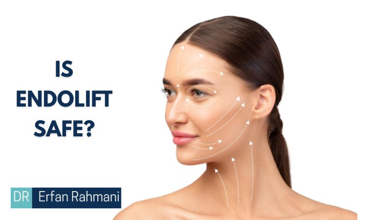 Endolift Side Effects