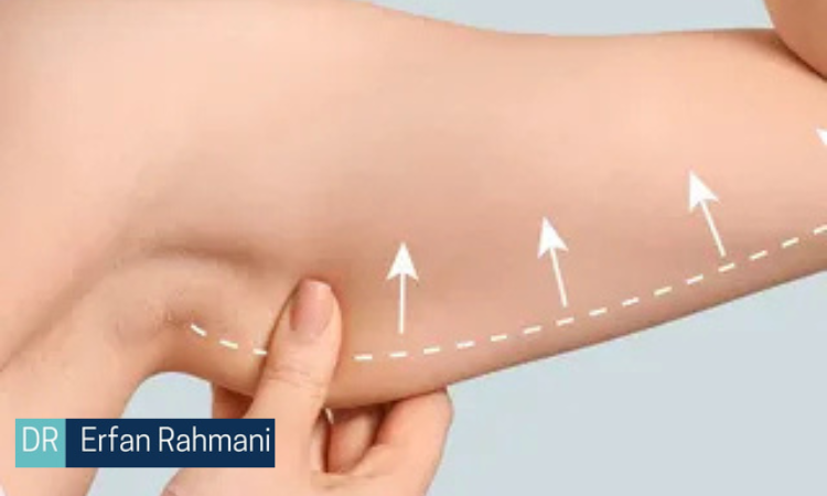 Endolift for Arm Abu Dhabi