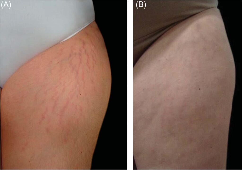 collagen biostimulator Abu Dhabi 