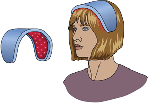 Hair Loss Assessment & Diagnosis Chart
