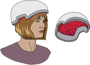 Hair Loss Assessment & Diagnosis Chart