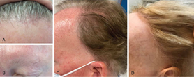 Hair Loss Assessment & Diagnosis Chart