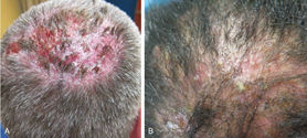 Hair Loss Assessment & Diagnosis Chart