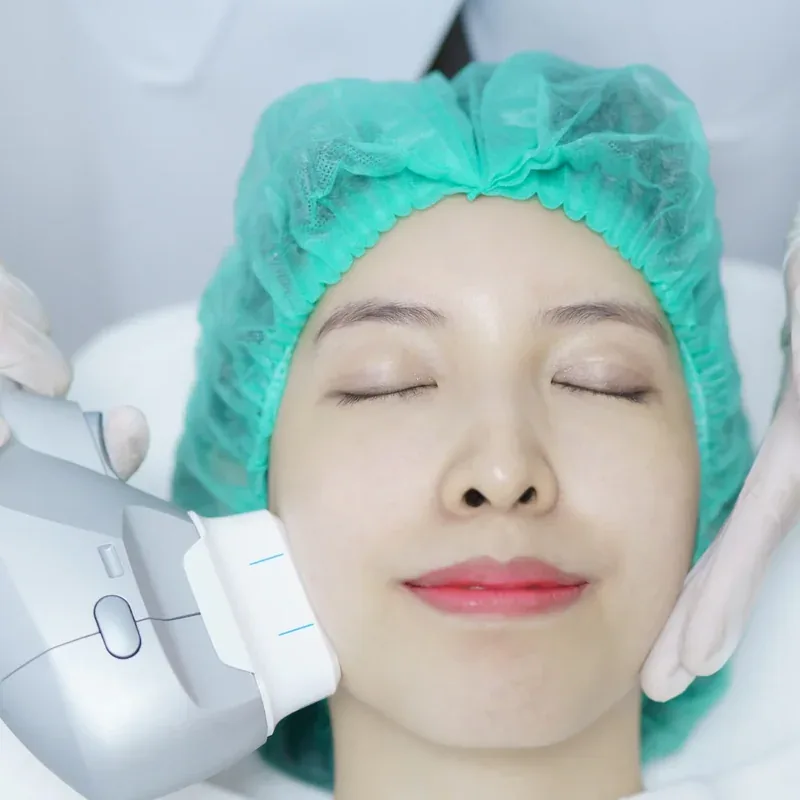 HIFU microfocused ultrasound facial skin tightening treatment in Abu Dhabi