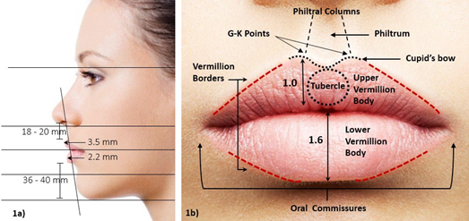Diagram of lip anatomy showing the Cupid’s bow, philtral columns, vermilion borders, tubercle, oral commissures and lip ratio