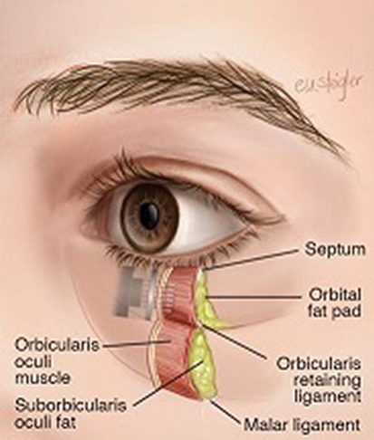 Periorbital anatomy for Morpheus8 Abu Dhabi: thin eyelid skin, orbicularis oculi, orbital fat pad and ligaments that determine safe RF depth